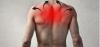 5 causas mais comuns de dor nas costas e como cuidar para ele