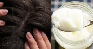 Como usar o óleo de coco para remover problemas de cabelo