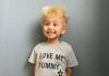 Criança dente de leão: o que é a síndrome do cabelo de descompactação?