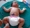 6 a 8 kg: os maiores recém-nascidos do mundo