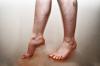 Violação do fluxo de sangue nas pernas: causas, sintomas