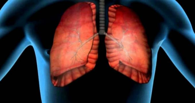 O cancro do pulmão