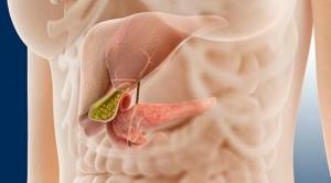 Inflamação do pâncreas: remover uma condição aguda em casa