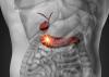 O principal sintoma de cancro do pâncreas