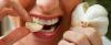 7 maneiras de como se livrar do cheiro da boca alho