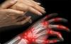 Os sintomas e as causas da artrite reumatóide como avisar