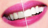 Como clarear os dentes em casa? conselho dental.