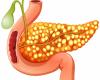Importantes sinais de má saúde do pâncreas