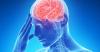 O risco de acidente vascular cerebral: 2 encontrou seu novo recurso