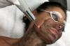 Peeling de carbono Laser: qualquer problema de pele traz para o ideal