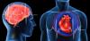 Ataque cardíaco e acidente vascular cerebral: 7 principais erros que eles provocam