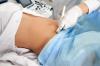 Quantas vezes você precisa fazer um ultrassom durante a gravidez, diz o médico