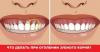 Como tratar as gengivas quando os dentes se tornam pescoço nu?