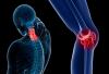 5 sinais de que você tem começa osteoporose